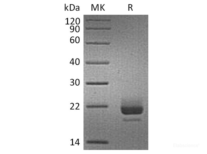 Recombinant Human CD40L / CD154 / TNFSF5 Protein (N-His)-Elabscience