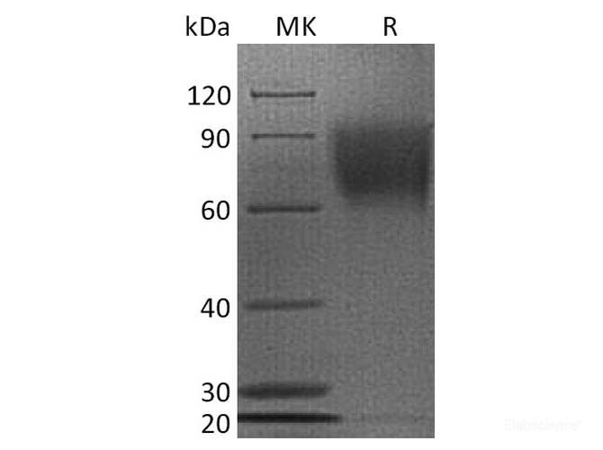 Recombinant Human CD30 / TNFRSF8 Protein (C-His)-Elabscience