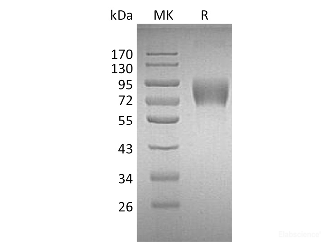 Recombinant Human CD226 / DNAM-1 Protein (C-Fc)-Elabscience