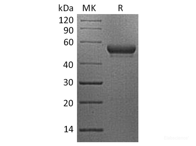 Recombinant Human CD160 / BY55 Protein (C-Fc)-Elabscience