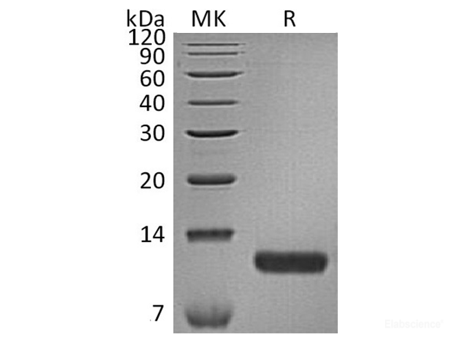 Recombinant Human CCL17 / TARC Protein (C-His)-Elabscience