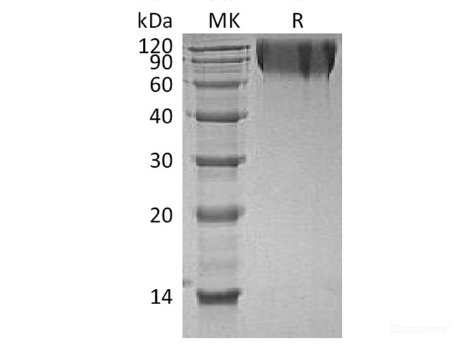 Recombinant Human CD66a / CEACAM1 Protein (C-His)-Elabscience