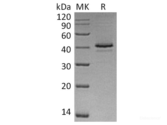 Recombinant Human CAMK1 / CaM kinase I Protein (C-His)-Elabscience