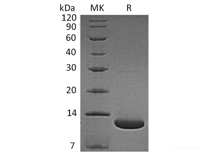 Recombinant Human Complement Component C5a / C5a Protein-Elabscience