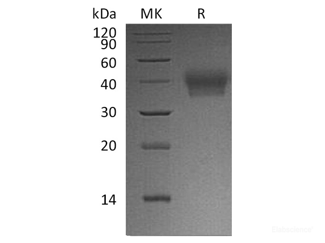Recombinant Human BTN2A Protein (C-His)-Elabscience