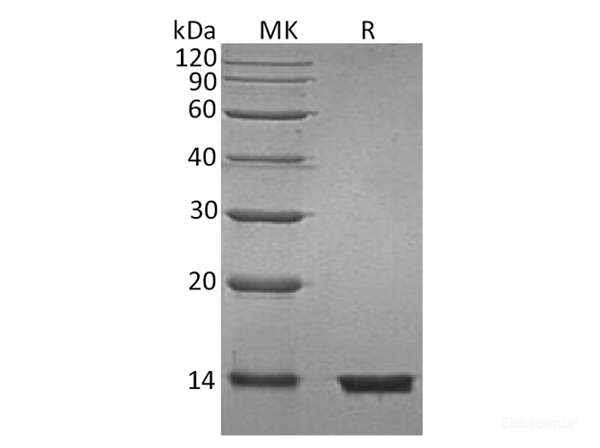 Recombinant Human B2M / Beta-2-microglobulin Protein (C-His)-Elabscience