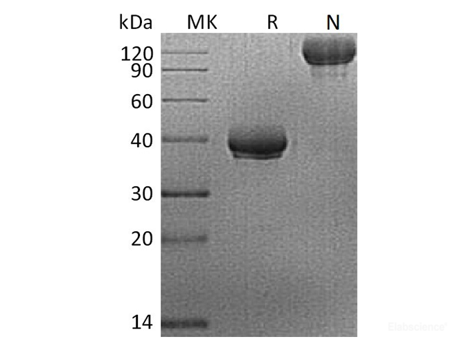 Recombinant Human BCMA / TNFRSF17 / CD269 Protein (C-Fc)-Elabscience