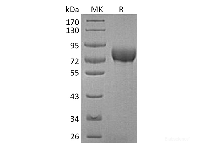 Recombinant Human BCAM Protein (C-His)-Elabscience