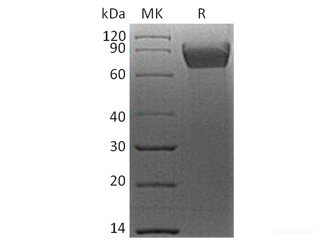 Recombinant Human B7-H4 / VTCN1 Protein (C-mFc)-Elabscience