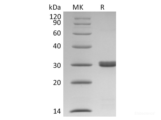 Recombinant Human BCL2L1 / Bcl-XL Protein (C-His)-Elabscience