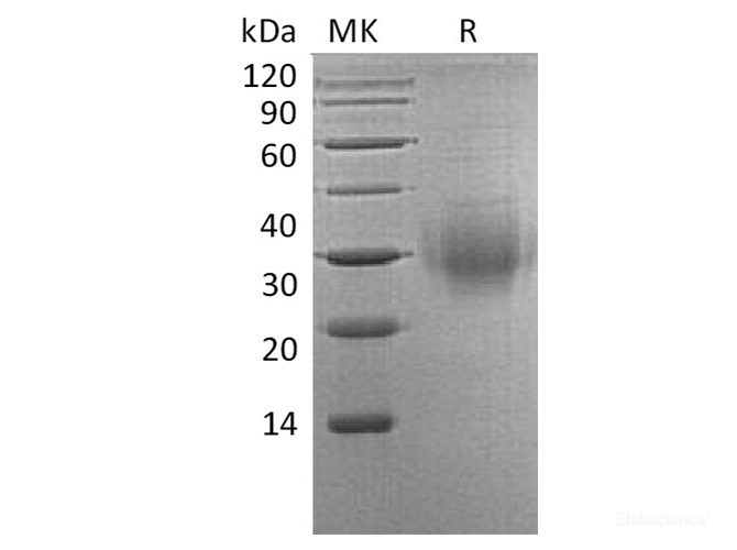 Recombinant Human BTLA / CD272 Protein (C-His)-Elabscience
