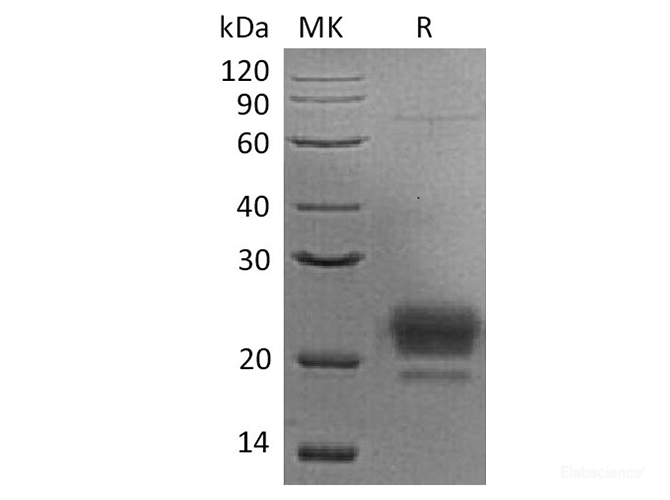Recombinant Human Apolipoprotein M / ApoM Protein (C-His)-Elabscience