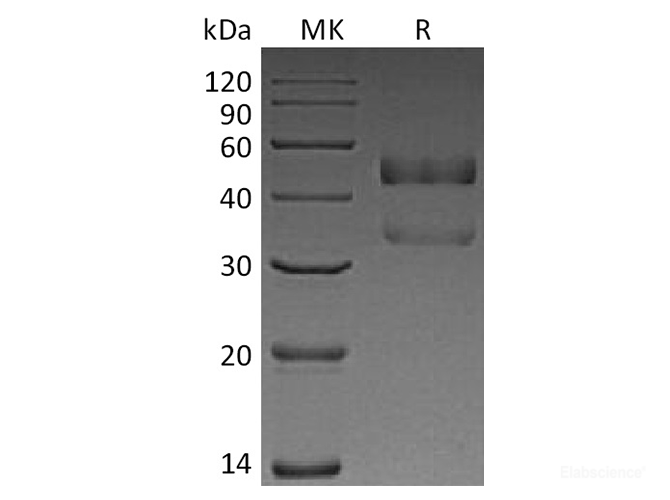Recombinant Human ANGPTL7 Protein (C-His)-Elabscience