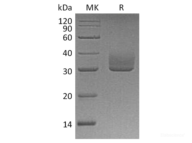 Recombinant Human ANGPTL3 Protein (C-His)-Elabscience