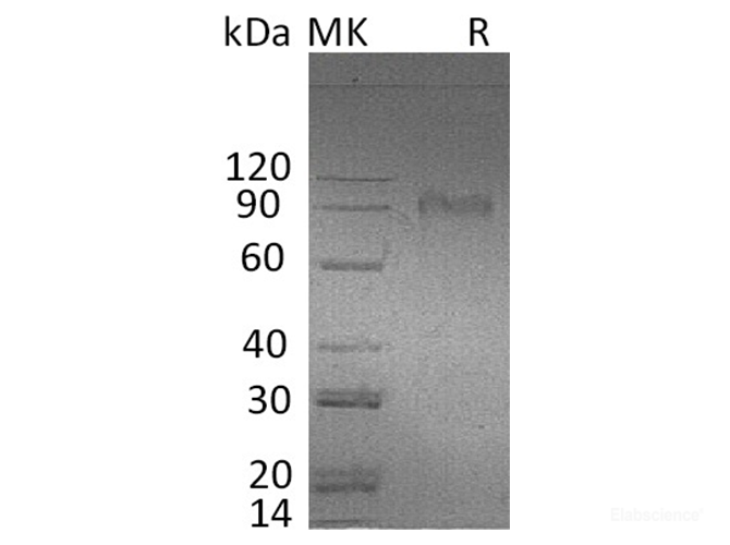 Recombinant Human AMIGO2 Protein (C-Fc)-Elabscience