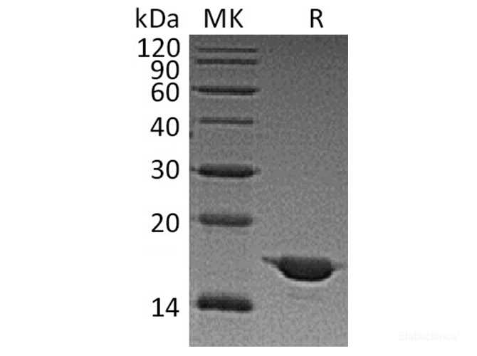 Recombinant Human SNCA / Alpha-Synuclein Protein-Elabscience