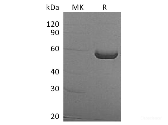 Recombinant Human ALDH1A3 Protein (N-His)-Elabscience