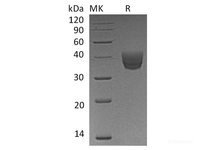 Recombinant Human CD157 / BST1 Protein (C-His)-Elabscience