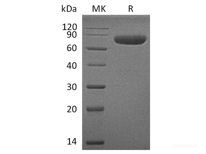 Recombinant Human CD38 / ADP-ribosyl Cyclase 1 Protein (C-mFc)-Elabscience