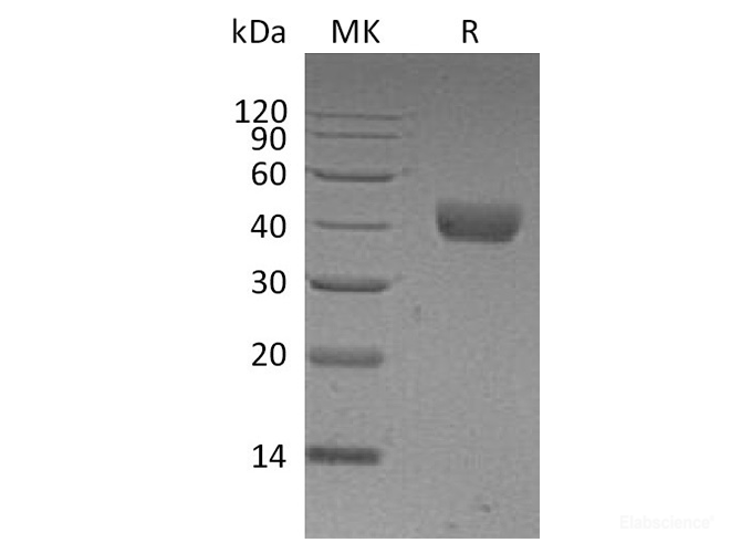 Recombinant Human CD38 / ADP-ribosyl Cyclase 1 Protein (C-His)-Elabscience