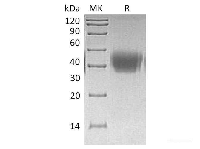 Recombinant Human Activin RIIA  / ACVR2A Protein (C-His)-Elabscience