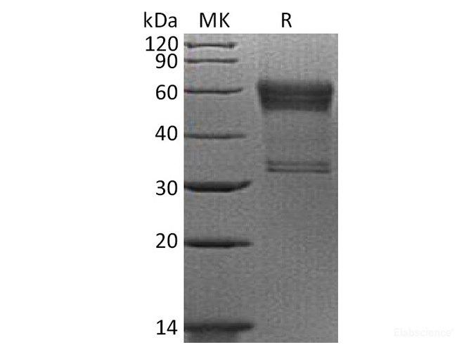 Recombinant Human 4-1BB / TNFRSF9 / CD137 Protein (C-mFc)-Elabscience