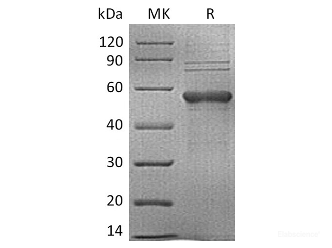 Recombinant Human TIM-3 / HAVCR2 Protein (C-mFc)-Elabscience