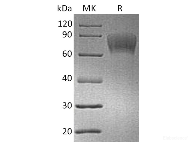 Recombinant Human CD30 / TNFRSF8 Protein (C-His-Avi)-Elabscience