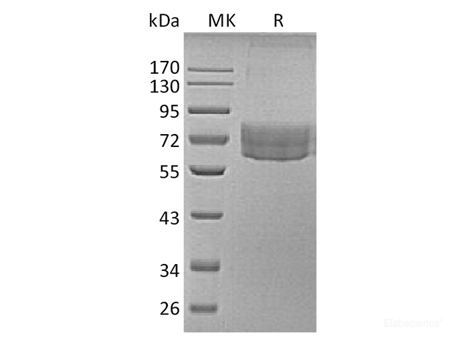 Recombinant Human TIM-3 / HAVCR2 Protein (C-Fc-Avi)-Elabscience