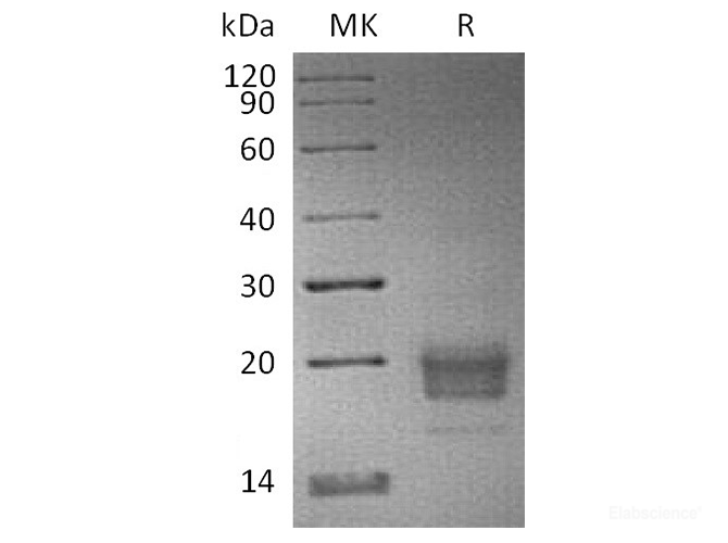 Recombinant Human TIGIT / VSIG9 / VSTM3 Protein (C-His-Avi)-Elabscience