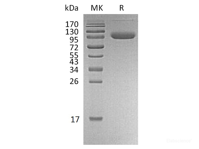Recombinant Human PD-L1 / B7-H1 / CD274 Protein (C-Fc-Avi)-Elabscience