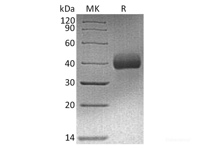 Recombinant Human EpCAM / TROP-1 / TACSTD1 Protein (C-His-Avi)-Elabscience