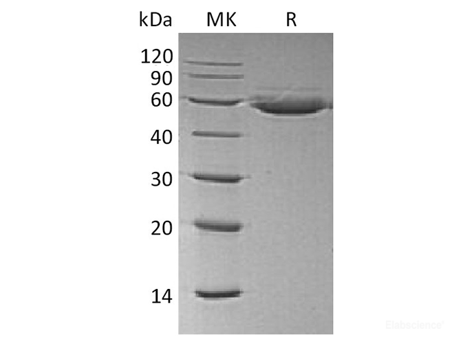 Recombinant Human CTLA4 / CD152 Protein (C-Fc-Avi)-Elabscience
