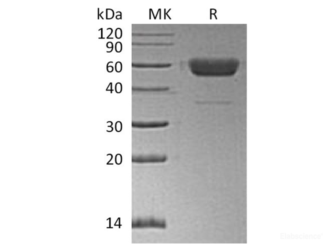 Recombinant Human / Mouse / Rat Irisin / FNDC5 Protein (C-Fc)-Elabscience