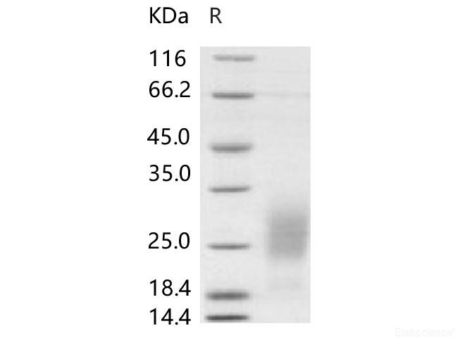 Recombinant Human GM-CSF Protein (HEK293 Cells) (His Tag)(Active)