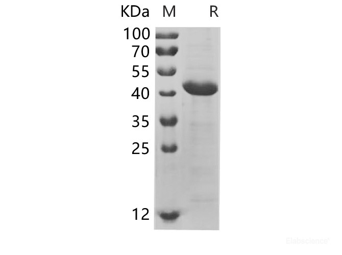 Recombinant Human KRT7 Protein (His Tag)-Elabscience