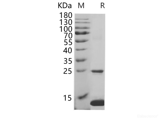 Recombinant Human S100A8 Protein (His Tag)-Elabscience
