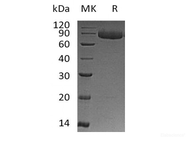 Recombinant Human IL-12 Receptor Subunit Beta1/IL-12RB1/CD212 (C-6His)