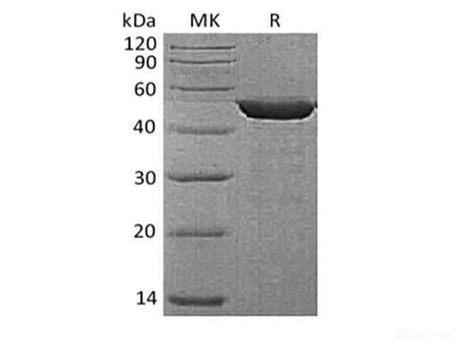 Recombinant Human Alpha-enolase/Enolase 1/MPB-1/NNE(C-6His)