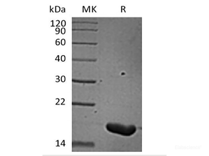 Recombinant Human IL-36 Beta/IL-1F8(157AA)