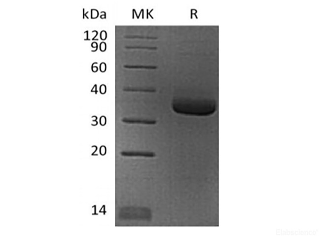 Recombinant Human Angiopoietin-Related Protein 4/ANGPTL4 (N-6His)