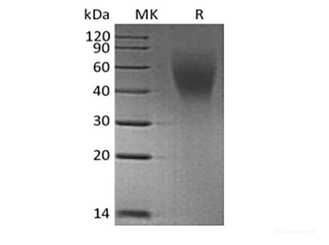 Recombinant Human CA125/MUC16 (C-6His)