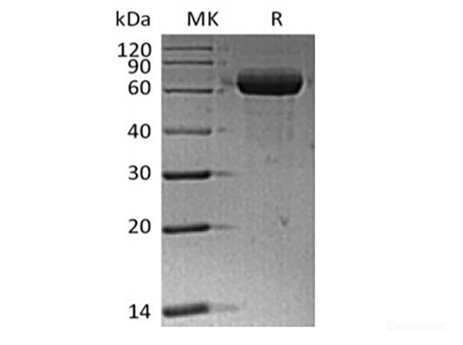 Recombinant Human Sialic acid-binding Ig-like lectin 15/Siglec-15/CD33L3 (C-Fc)