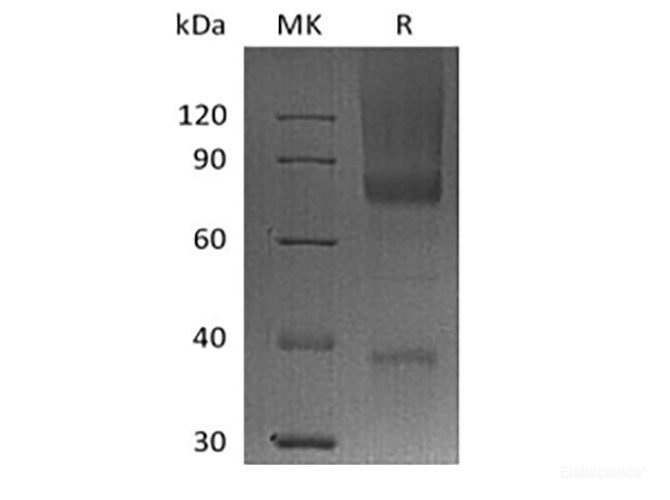 Recombinant Human Glypican-3/GPC3/OCI5 (C-6His-Avi) Biotinylated