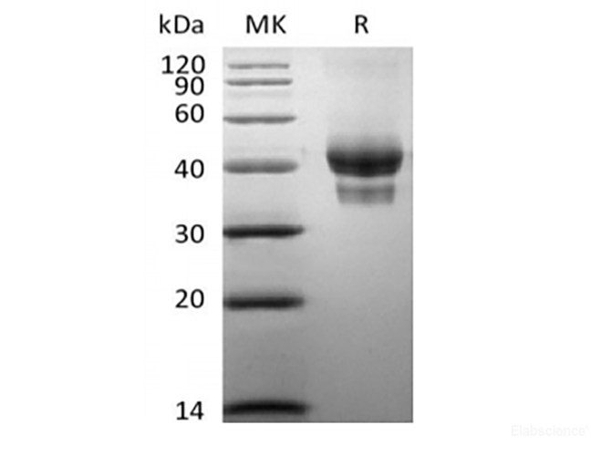 Recombinant Human BCMA/TNFRSF17 (C-Fc-Avi) Biotinylated