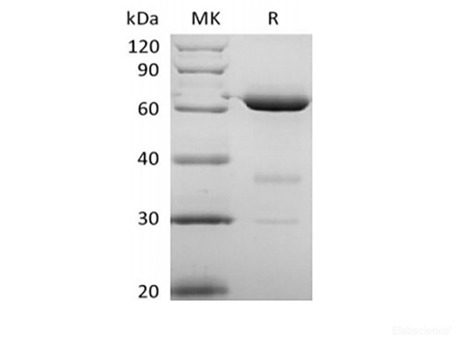 Recombinant Human 5'-Nucleotidase/5'-NT/CD73 (P21589, C-6His)