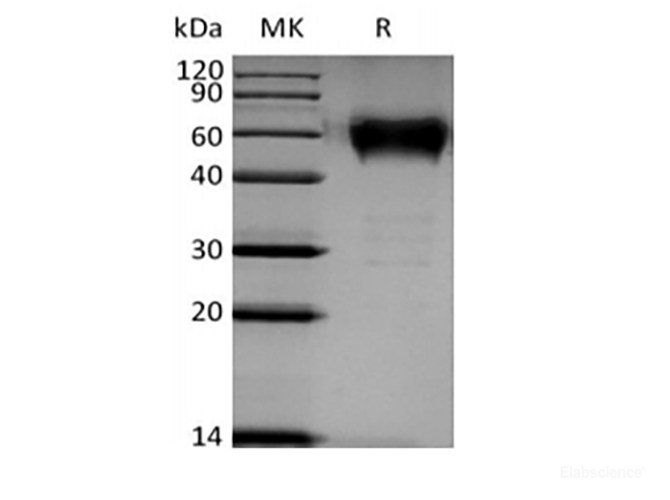 Recombinant Human B- and T-Lymphocyte Attenuator/BTLA/CD272 (C-mFc)