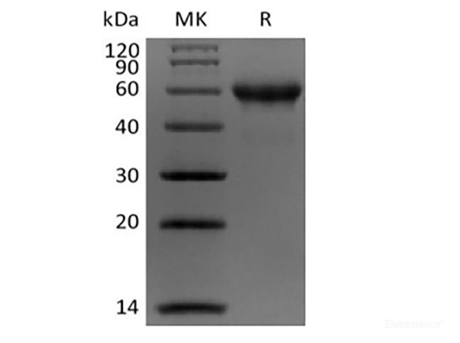 Recombinant Human Carbonic Anhydrase IX/CA9 (C-Avi-6His) Biotinylated