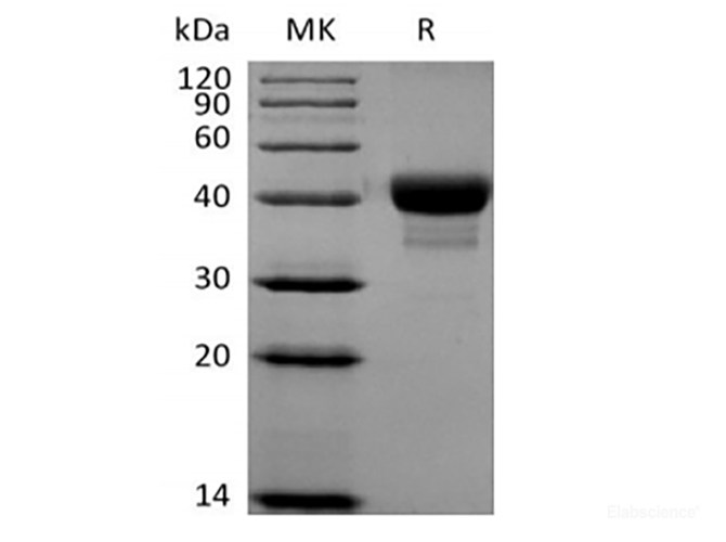 Recombinant Human CD52 (C-Fc-Avi) Biotinylated