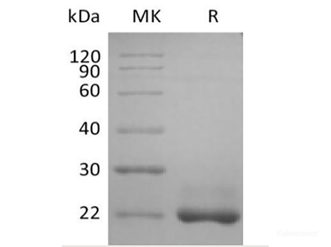 Recombinant Human TNFSF13B/BAFF/CD257 (N-6His)